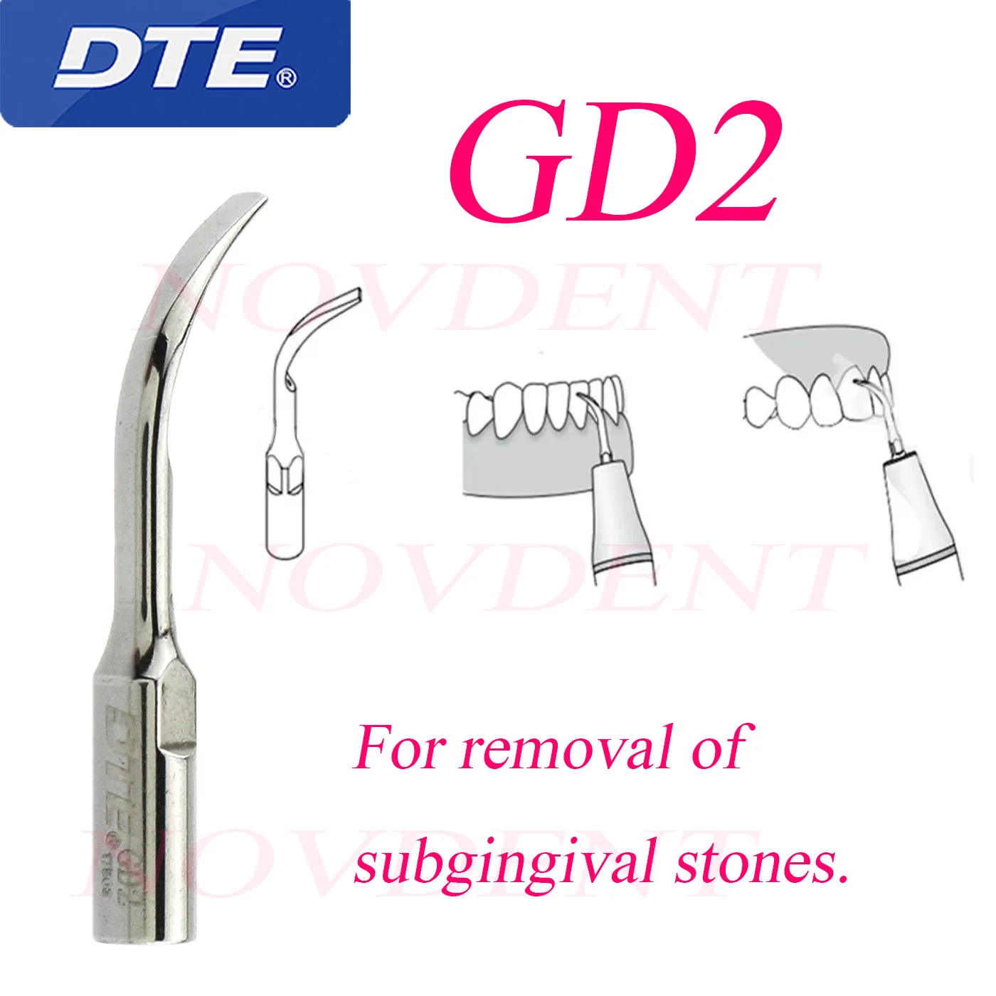 Дятел Стоматологический инструмент DTE Ультразвуковой рабочий наконечник для