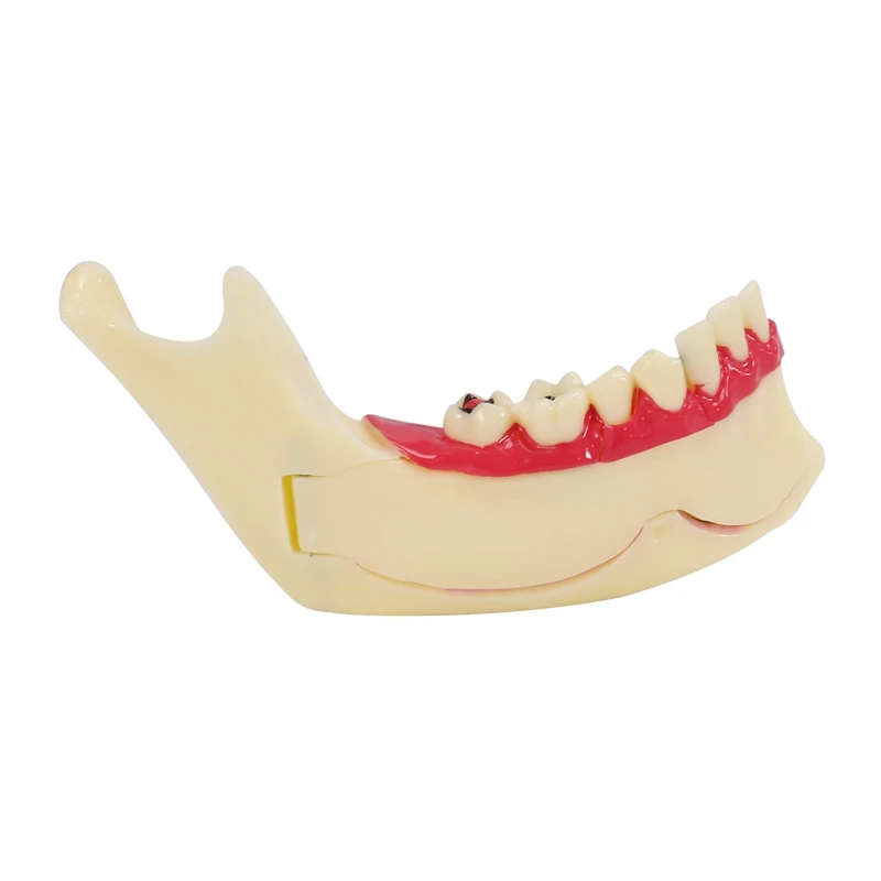 

Treatment Model Anatomy Of Gums Study Teach Teeth Model