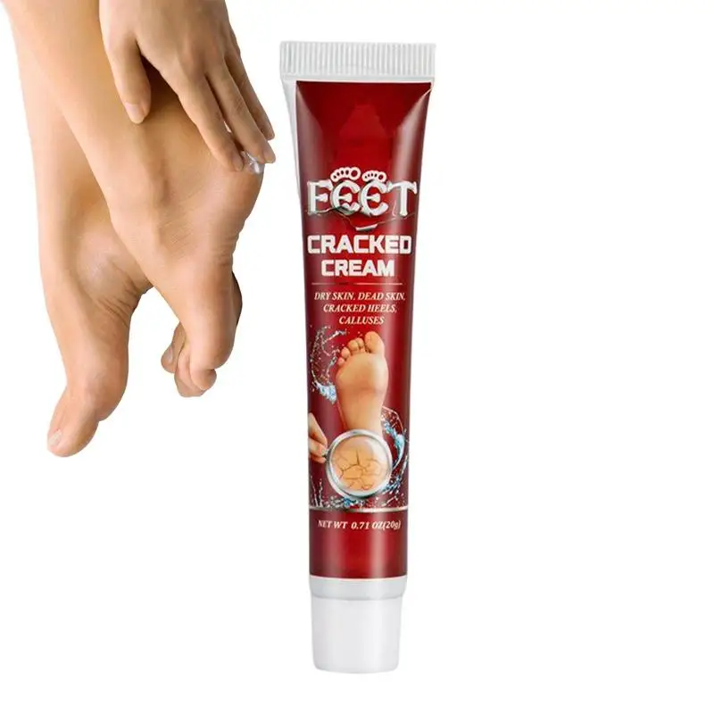 

Foot Cream Peppermint Foot Cream Callus Remover Moisturizes Rehydrates Thick Cracked Rough Dry Skin For Feet Elbows And Hands