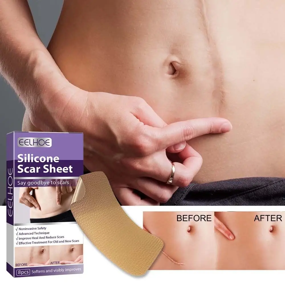 

8pcs/box Silicone Scar Sheets Tape For Scar Skin Repair Patch Self-Adhesive Stretch Mark Tape Removal Burn Scar Skin Care
