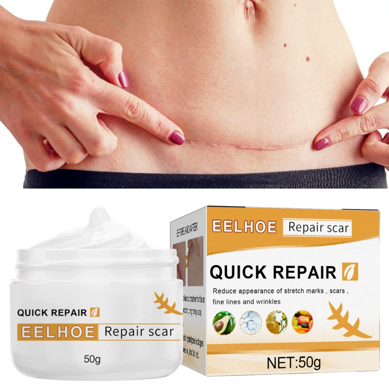 

Scar Removal Cream 50g Scar Cream Scar Remover Scar Remover Acnes Scar Cream Old And New Scar Repair Cream For Face And Body