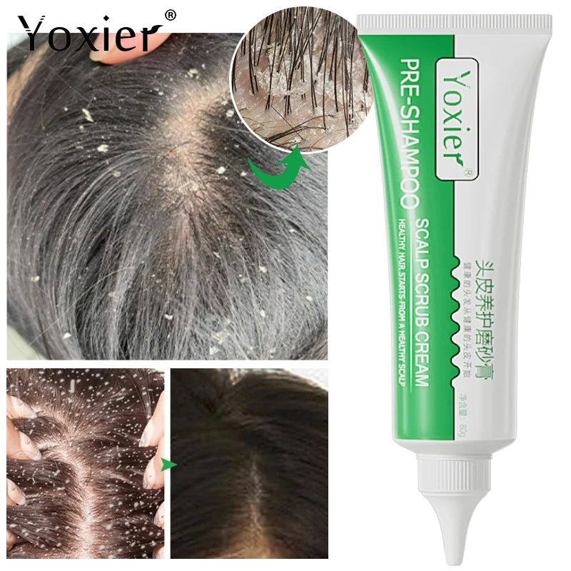 

Pre-Shampoo Scalp Scrub Cream Oil Control Anti-Dandruff Antipruritic Reduce Hair Loss Deep Cleaning Mild Hair Scalp Care 80g