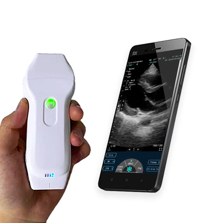 Wireless ultrasound for home and medical linear and cardiac applications C10XL medical ultrasound instruments