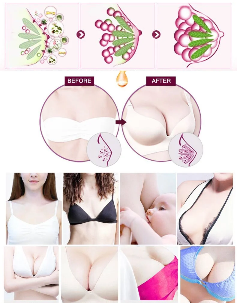 Крем для улучшения груди MOSSLAY крем увеличения объема Женский гормон быстрого