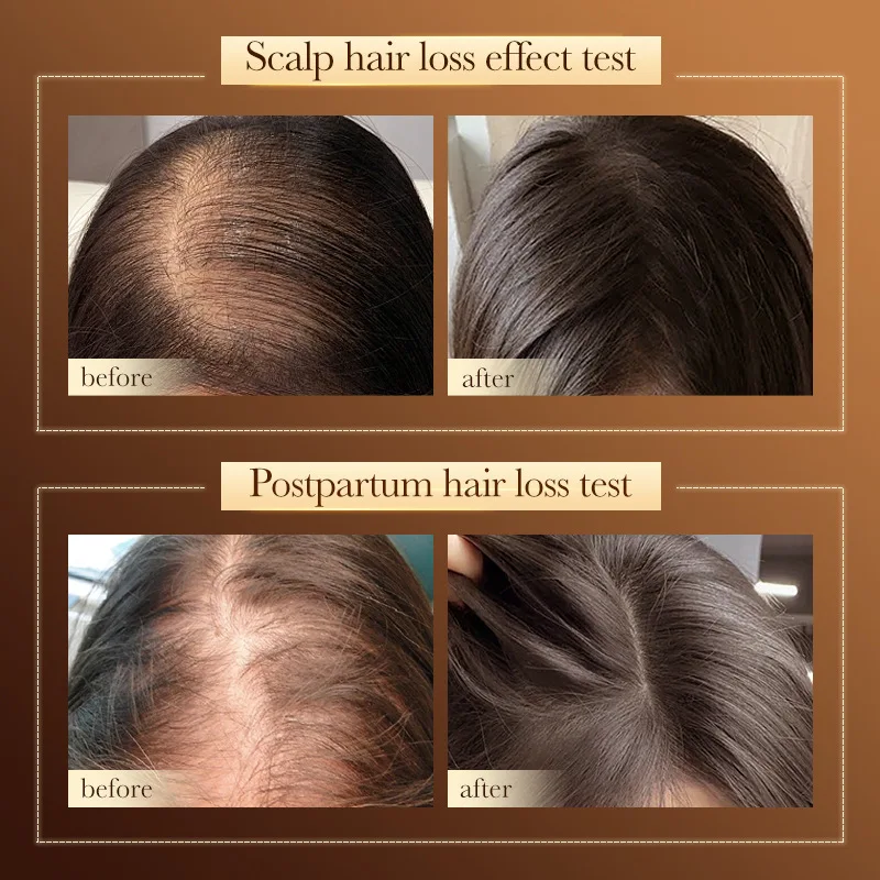 Увлажняющий гладкий чистый шампунь против выпадения волос предотвращает