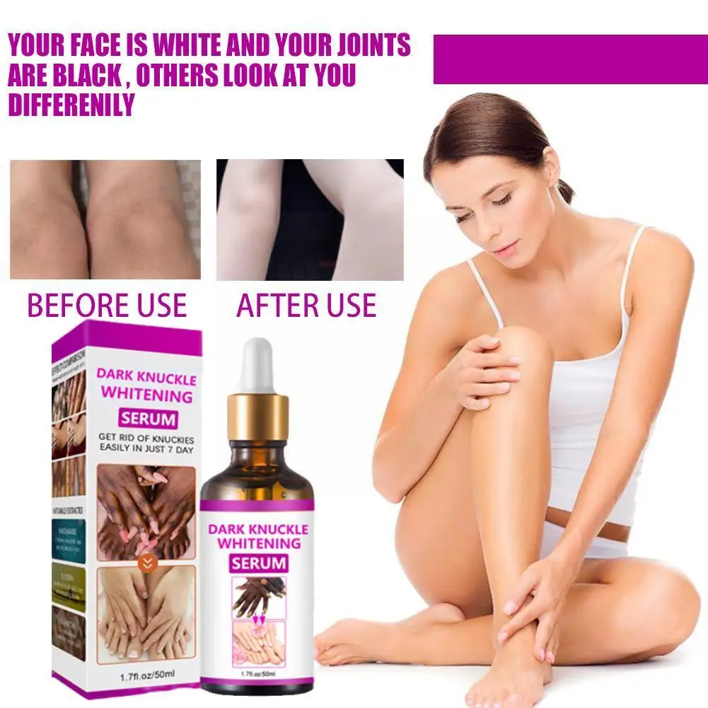 

Отбеливающая Сыворотка для суставов рук и ног, эффективное отбеливание, удаление тела, уход за коленями, костяшками колена, средство для ухода за кожей Essen Y9X1