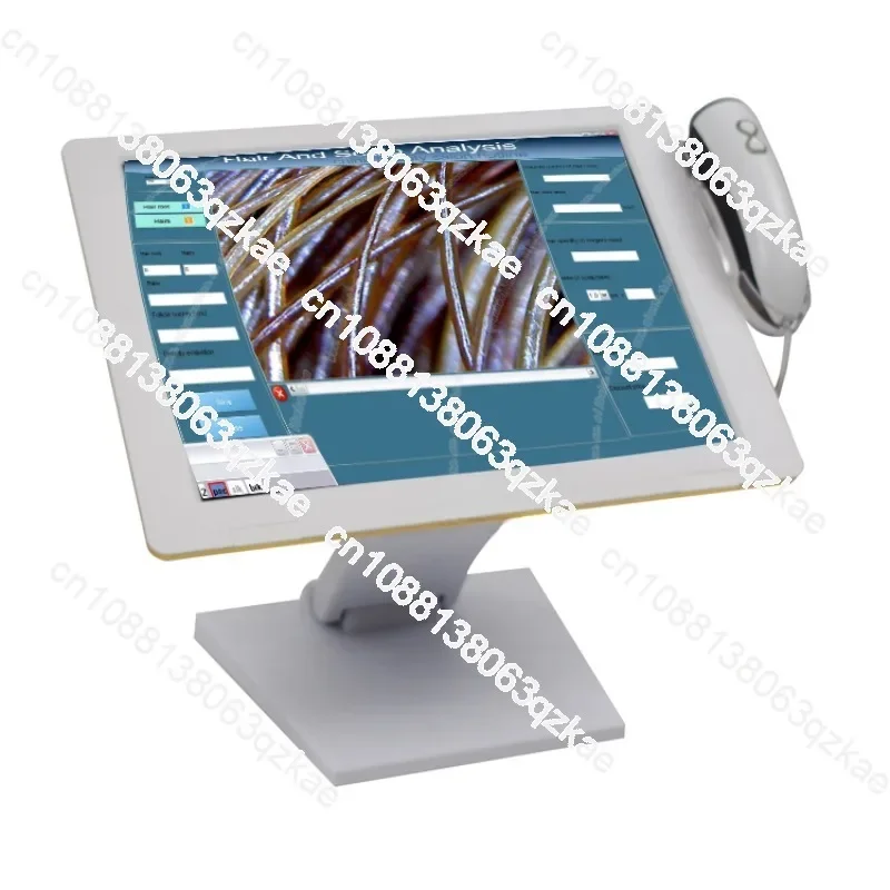 Профессиональное программное обеспечение для анализа кожи головы обнаружение