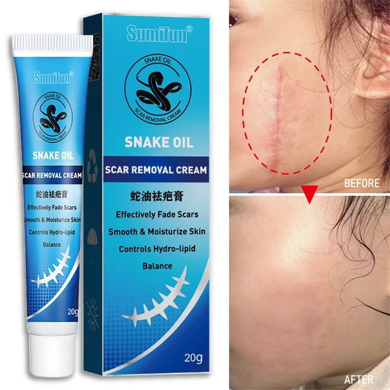 

Herbal Scar Removal Cream Stretch Marks Treatment Pimples Spots Repair Gel Promote Cell Regeneration Natural Plaster Skin Care