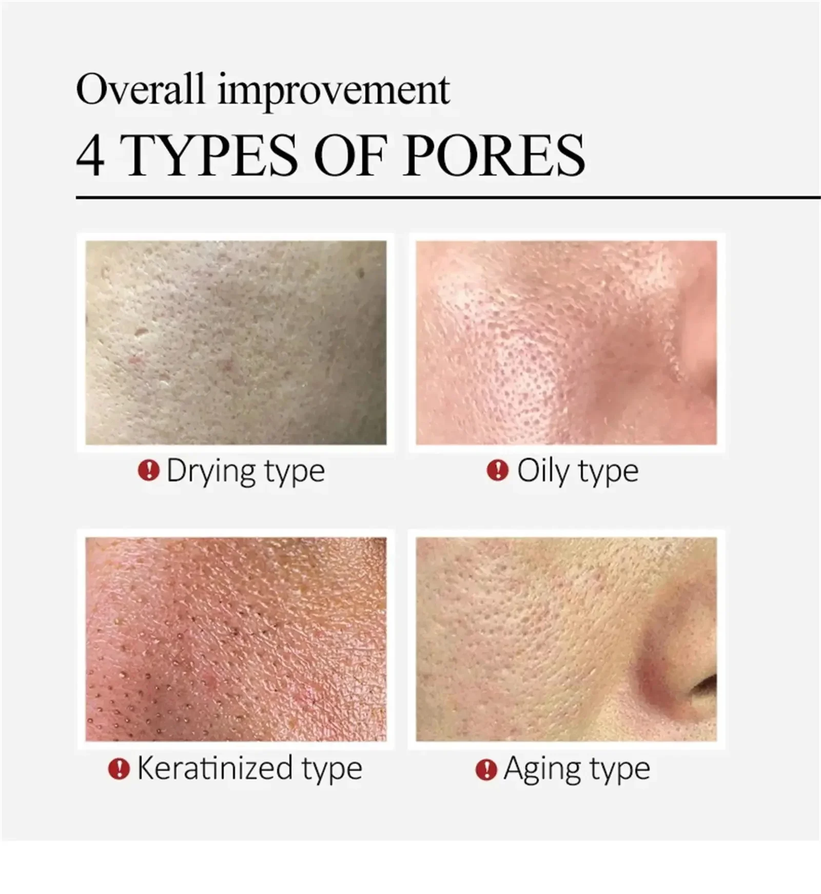 Сыворотка для сужения пор пилинг лица удаление больших подтяжка восстановление