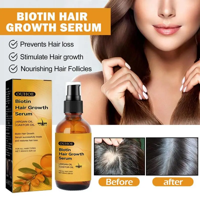 

60ml Hair Growth Oil Biotin Hair Loss Repair Oil Recover Dry Damaged Hair Quality Hair Care Oil For All Hair Types