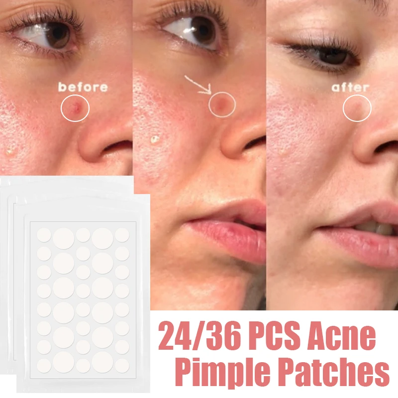 

24/36 Patches Acne Pimple Patch Face Invisible Stickers Quick Effect Treatment Removing Patches Beauty Acne Tools Face Skin Care