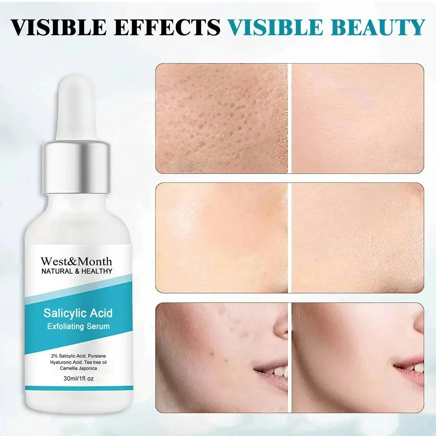 Hot sales Salicylic Acid Serum Exfoliating Face Moisturizer Deep Cleansing Facial Moisturizing oil control Essence Korean