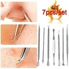 Инструмент для чистки угрей, игла для удаления угрей иглы, 74 шт. (без коробки)