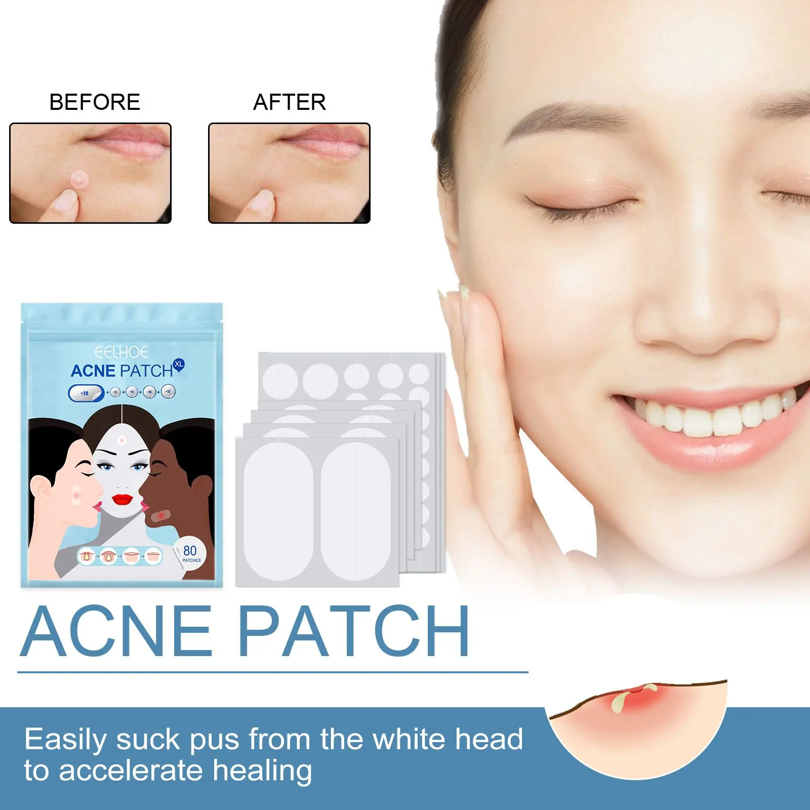 80PCS 8mm/10mm/12mm/14mm Acne Pimple Patches Skin Tag Remover Patch Spot Treatment with Tea Tree&ampCalendula Oil Face Care - купить по