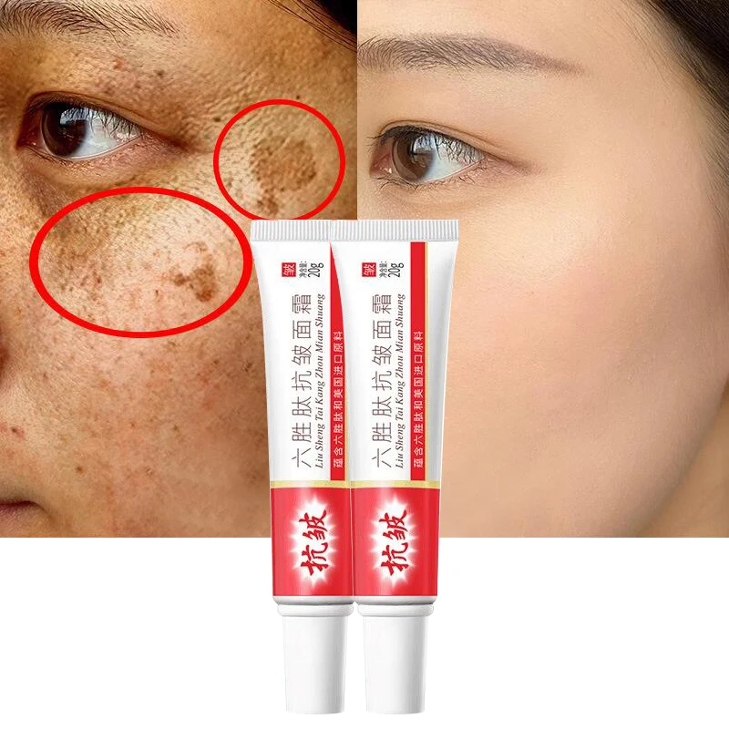 

2PCS Whitening Freckle Face Cream Remover Melasma Dark Spots Fade Melanin Pigmentation Improve Dull Brighten Nourish Skin Care