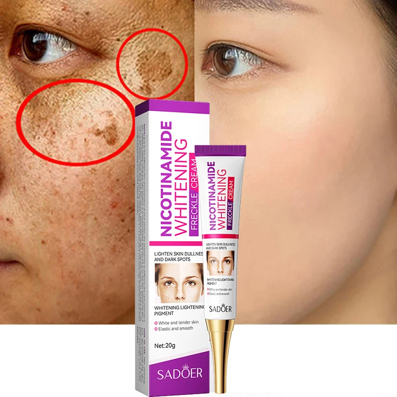 

Nicotinamide Whitening Freckle Remove Face Cream Fade Dark Spot Lighten Melasma Melanin Moisturizing Brighten Skin Care Products