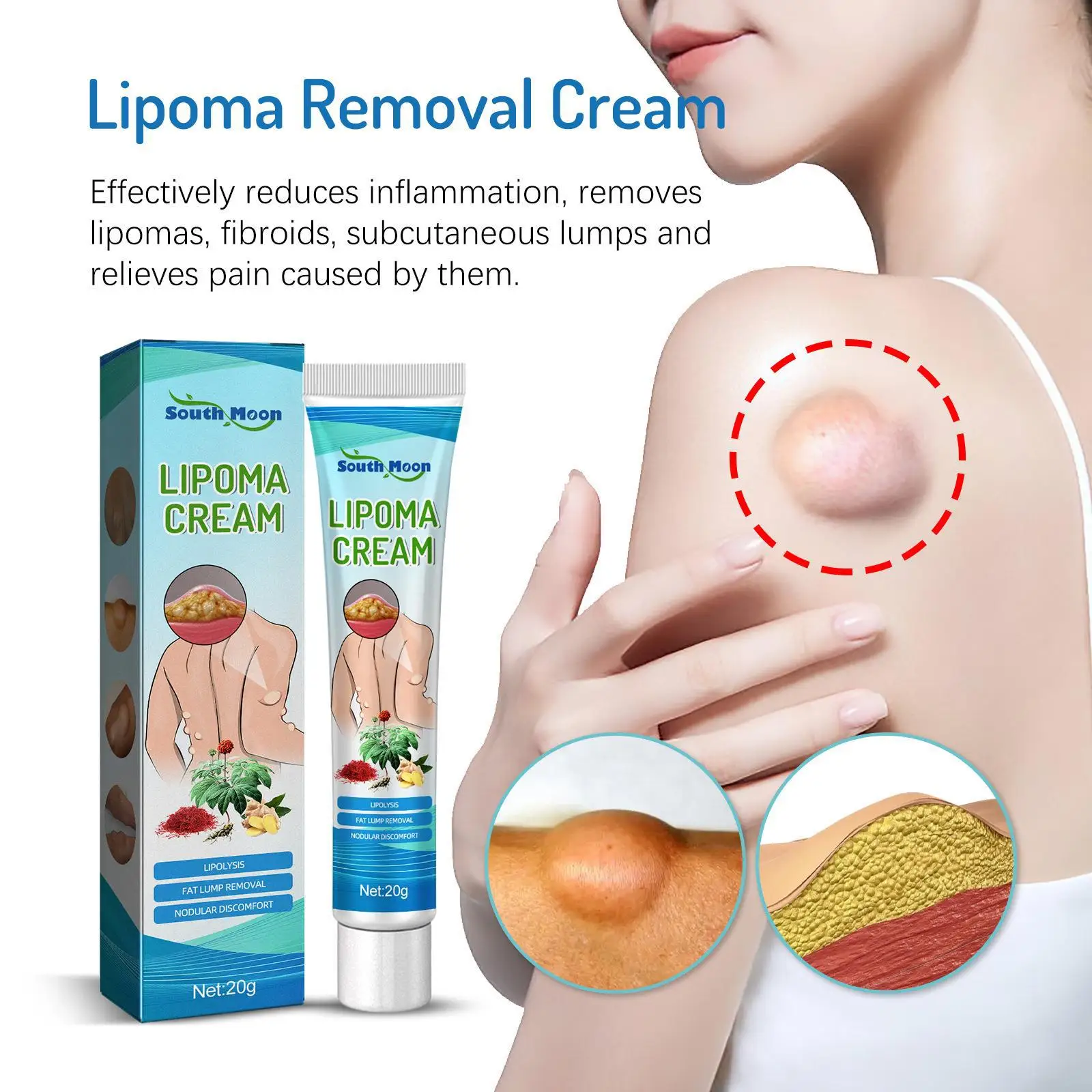 

Крем Lipoma для удаления жира и целлюлита, мазь от боли в коже, отеков, липолиза, укусов ногтей, 20 г