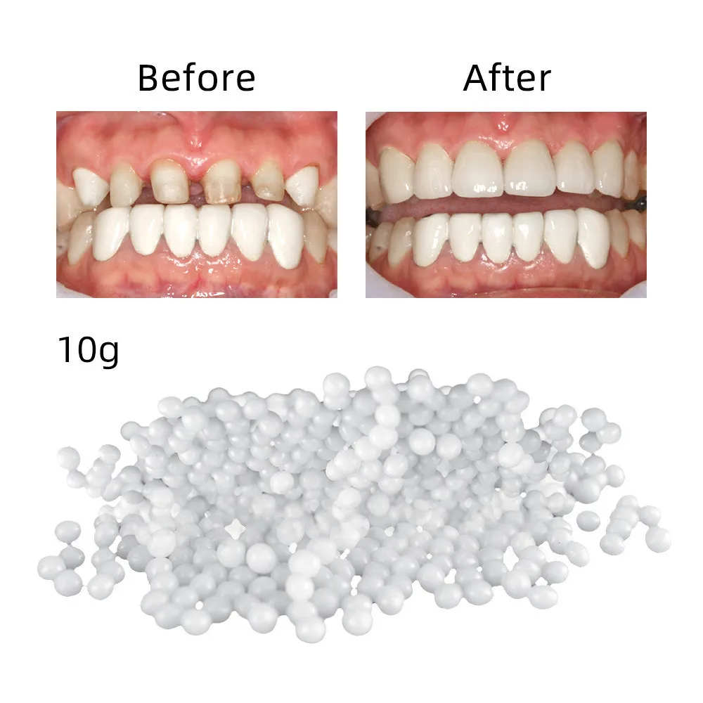 

10g Temporary Tooth Repair Kit Teeth And Gaps FalseTeeth Solid Glue Denture Adhesive Teeth Whitening Tooth Beauty Tool