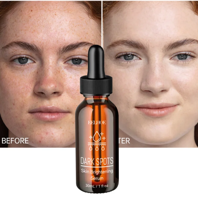 

Quickly Reduces Spots Fine Lines Brighten Skin Serum Anti-aging Anti-wrinkle Facial Serum Remove Dark Spots Whiten Skin Essence