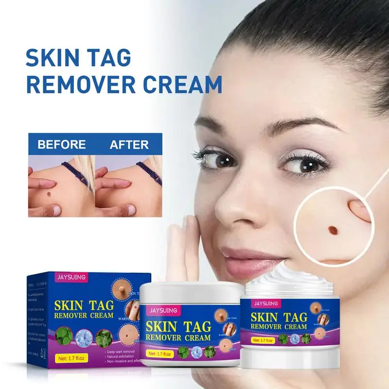 

Skin Tags Removal Cream Skin Tags Callus Remover Cream Painless Fast Action Moles Warts Remover For Womens Skin Care Beauty