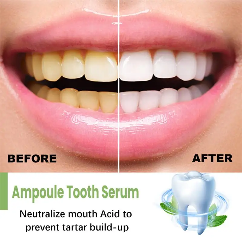 

EELHOE Teeth Whitening Essence Cleaning Oral Hygiene Fresh Breath Whitening Teeth Care Gum Health Care 2023 NEW