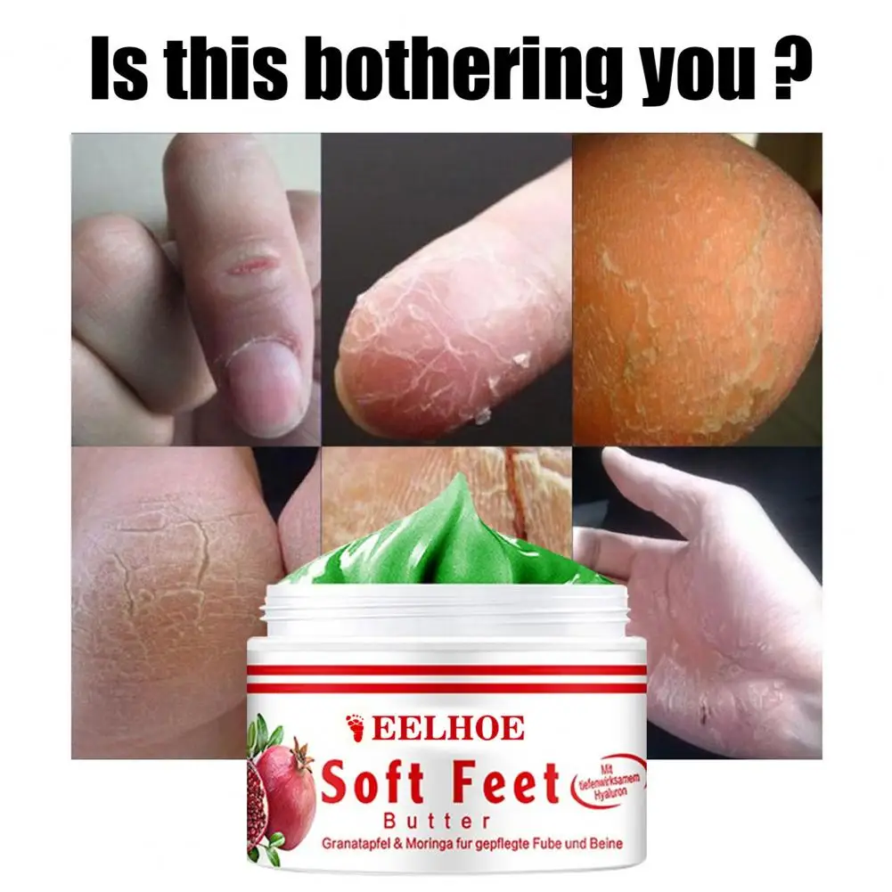 

15g/30g/50g Foot Repair Cream Moisturizing Dead Skin Removal Foot Care Heel Cracked Repair Cream for Women Men