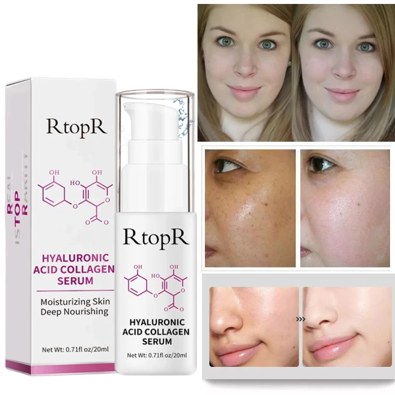 

RTOPR Hyaluronic Acid Collagen Face Serum Acne Treatment Anti Wrinkle Skin Care Essence Face Care Whitening Anti-Aging Serum