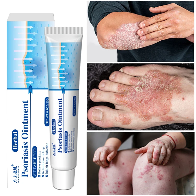 

10pcs Antibacterial Body Cream Psoriasis Ointment Herbal Treatment Fungus Eczema Anti-itch Relief Rash Urticaria Desquamation