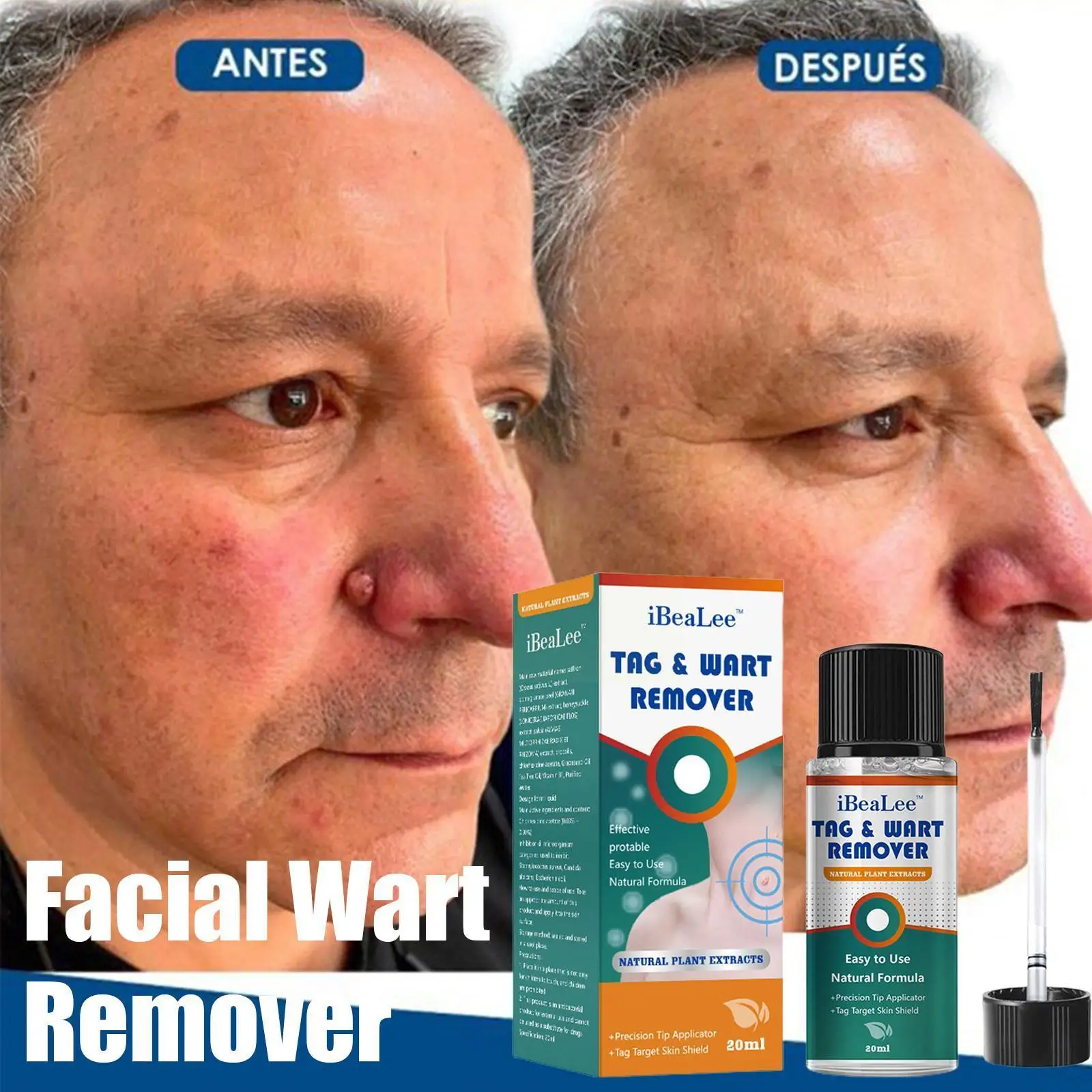 

Skin Tags Remover Painless Mole Skin Dark Spot Warts Oil Freckle Cream Tag Treatment Wart Removal Essential Remover Serum F A9P0