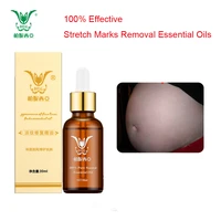 30ml stretch marks removal essential oils pure natural stretch marks remover postpartum anti wrinkle repair cream free shipping