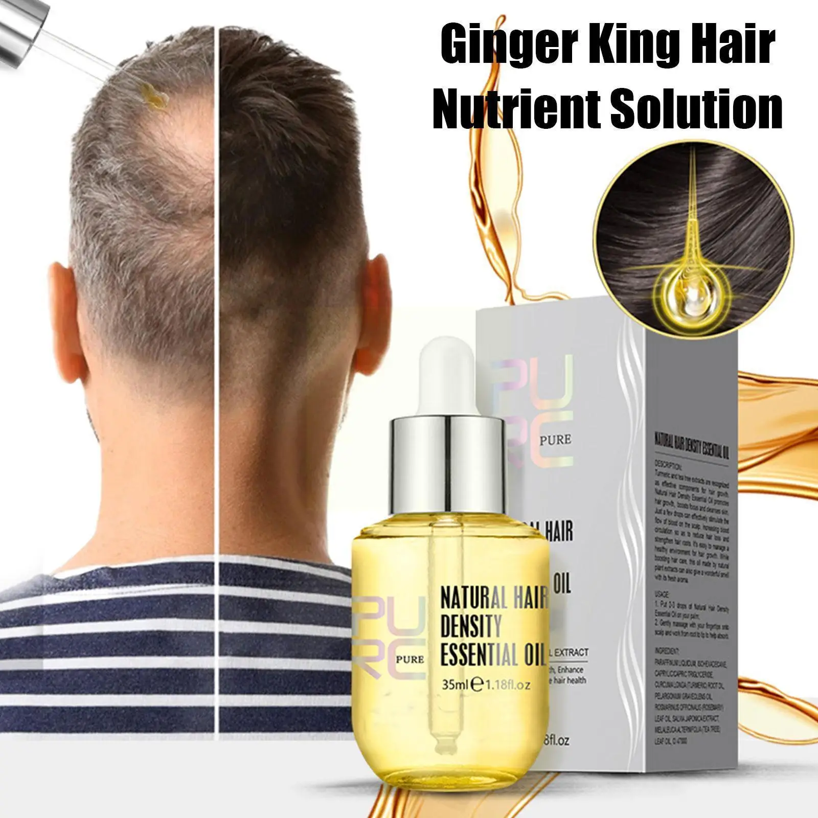 

1PCS 35ml Ginger Essence for hair growth Oil Men Women Thickening Grow Hair Treatment Products Dropshipping S2F3