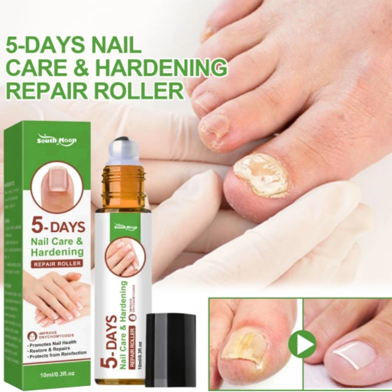 

5 Days Nail Growth And Hardening Repair Roller Nail Repair Softening Nail Removing Thickening Nail Brightening Nutrient Solution