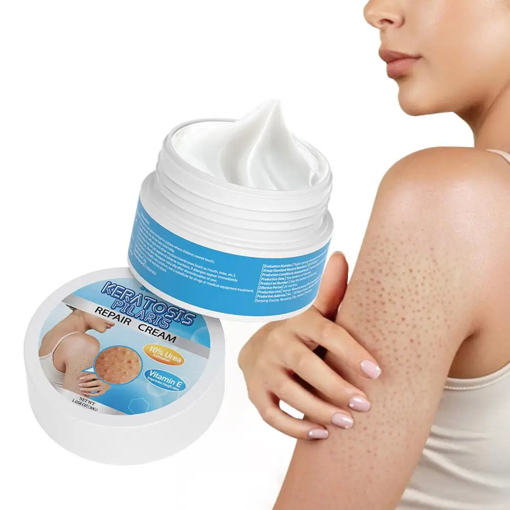 

Vitamin E Strawberry Legs Removal Body Scrub Chicken Moisturizer Care Pimple Cream Exfoliating 30g Whitening Urea Skin Skin F0E7