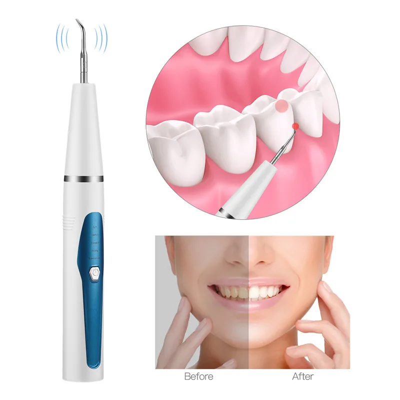 

Электрический стоматологический аппарат для удаления зубного налета, скребок для чистки зубов, ультразвуковой стоматологический аппарат ...