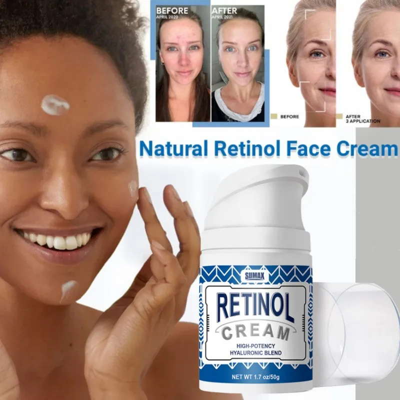 

Natural Retinol Cream Anti-wrinkle Anti-aging Fade Fine Lines Freckle Removing Lift Firming Acne Treatment Moisturizing Cream