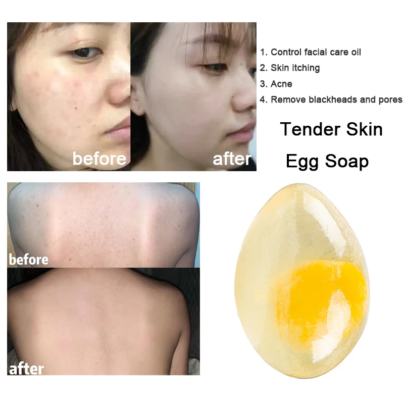 

80g collagen skin egg soap skin rejuvenation whitening acarid removing skin cleansing privacy care handmade soap whole body soap