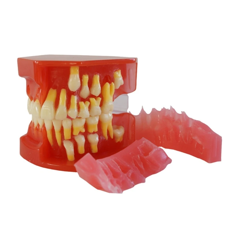 

L43D Teeth Model with 28 Detachable Teeth Restoration Demonstration Model