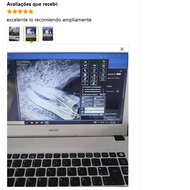 Стоматологический радиовизограф датчик рентгенографии высокочастотная