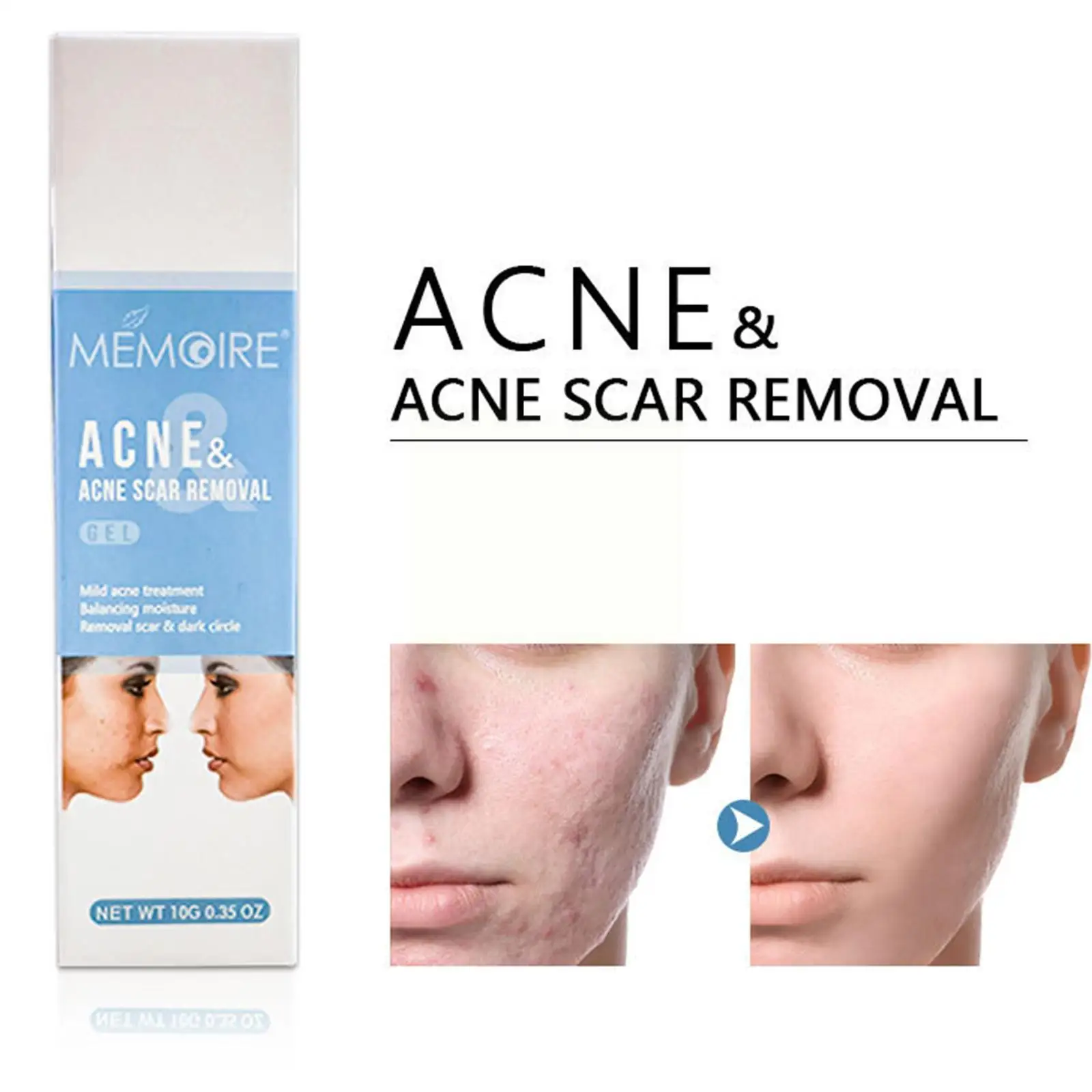 

10g Herbal Acne Removal Face Cream Oil Control Anti-Acne Pimples Skin Eliminate Whitening Treatment Cream Facial Care Gel A M1S2