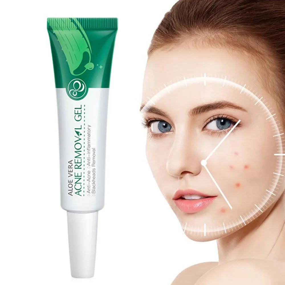 Aloe Acne Removal Face Cream Oil Control Moisturizing Beauty Skin Care Gel Shrink Pores Brighten Nourishing Repair Cosmetics