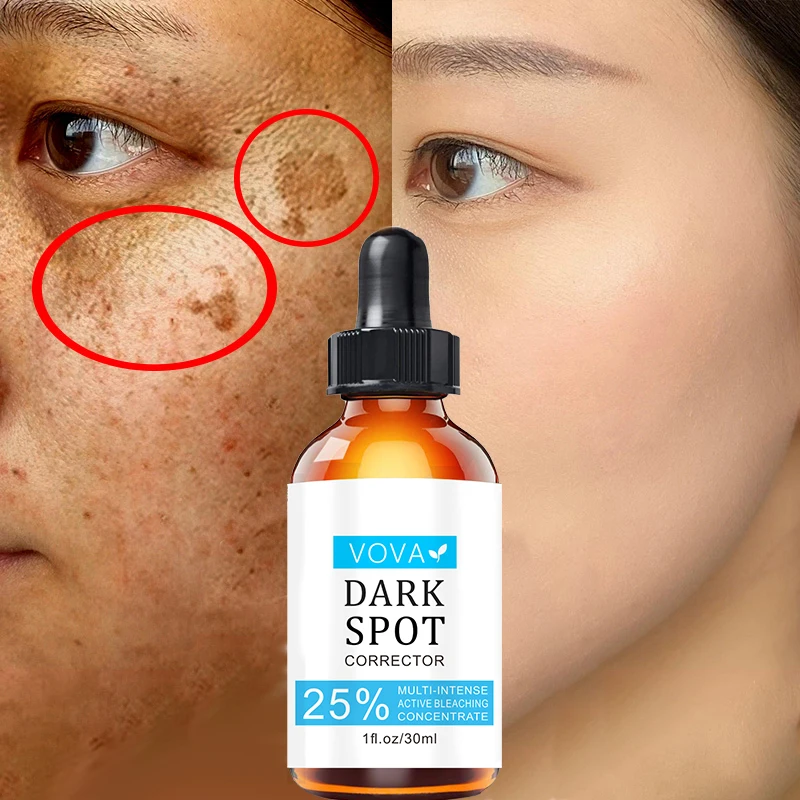 Эффективная мерная Сыворотка для лица эритрокорректор крем против веснушек