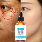 Эффективная мерная Сыворотка для лица, эритрокорректор, крем против веснушек, Обесцвечивающий, пигментационный, мелазма, осветляющая сыворотка