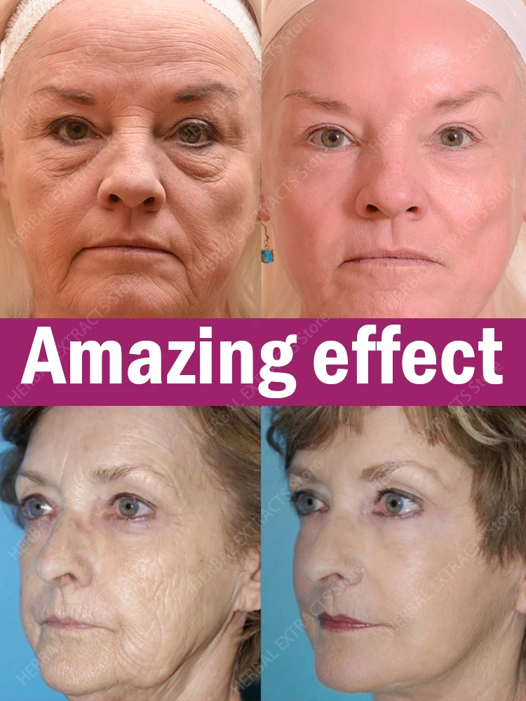 

Anti-wrinkle and Anti-Aging Serum. Eliminate Facial Wrinkles Fine Lines Around The Eyes Crow's Feet