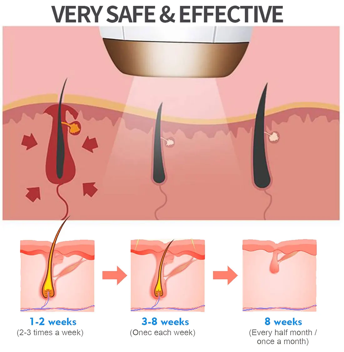 Лазерный эпилятор для удаления волос WOOCOM IPL депилятор устройство депиляции