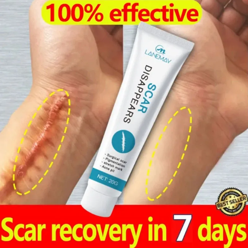 

7-Day Recovery Scar Cream Fast Removal Stretch Marks Burn Keloids Treat Surgery Scar Pigment Herbal Repair Skin Scars Smooth Gel