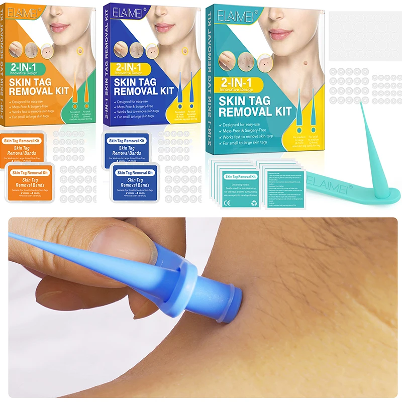 

Skin Tag Removal Tool Set Skin Tag Removal Kit Home Use Mole Wart Remover Equipment Micro Skin Tag Treatment Skin Care