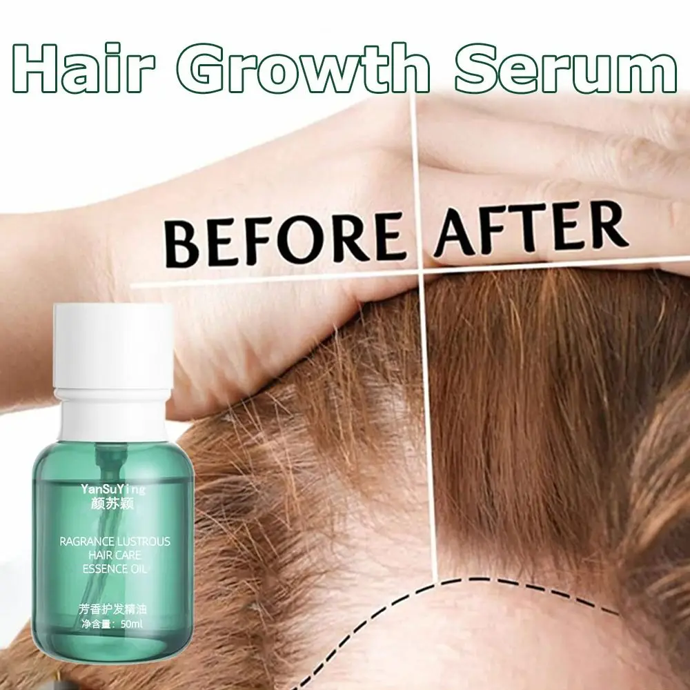 

50 мл Лидер продаж, восстанавливающий эффект кожи головы, сыворотка для красоты волос, сыворотка для роста волос, выпадение волос, уменьшение...