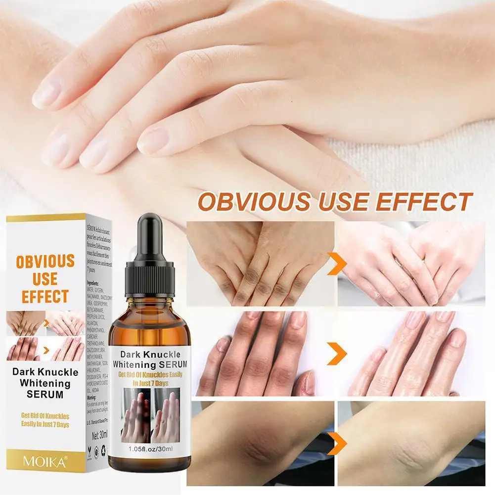 

Сияющая Сыворотка для суставов рук, эссенция для удаления суставов, темных костяшек, 50 цветов, S X6L1