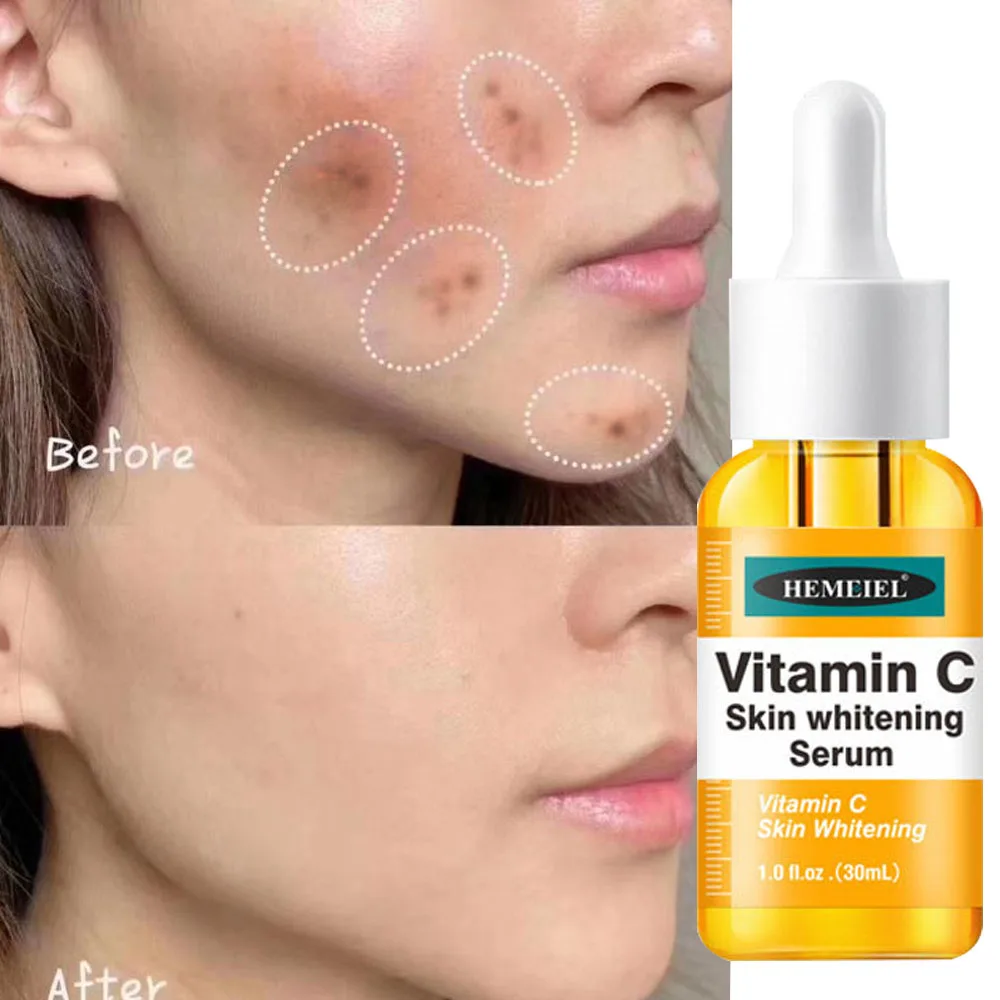 Vitamin C Whitening Face Serum Remove Dark Spot Fade Melasma Freckle Anti-Aging Brighten Moisturizing Skin Care Korean Cosmetics