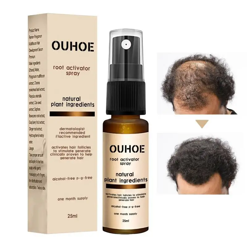 

Hair Growth Spray Hair Regeneration Spray For Men Hair Volumizing Spray Hair Regrowth Spray Thickening 25ml Promotes Regrowth